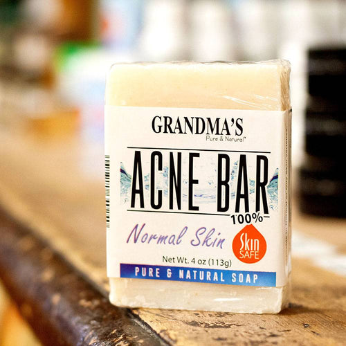 Handcrafted acne soap bar labeled for normal skin and skin-safe formulation, displayed on a rustic wooden surface in Health & Wellness and Soaps collections.