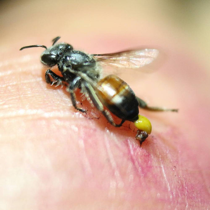 Close-up of a bee with a stinger embedded in human skin, illustrating the need for fast relief products featured in Health & Wellness, Camping, and USA Made collections.