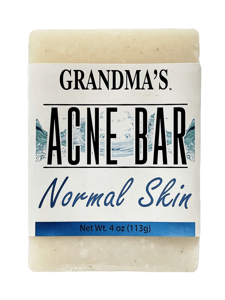 Handcrafted acne soap bar labeled for normal skin, featuring soothing ingredients, designed to help clear blemishes, part of Health & Wellness and Best Sellers collections.